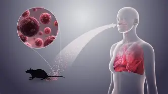 SUBIERON LOS CASOS DE HANTAVIRUS