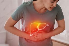 CRECEN LAS CONSULTAS POR HIGADO GRASO