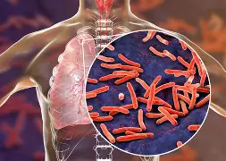 INFORMES SOBRE TUBERCULOSIS EN LAS ESCUELAS